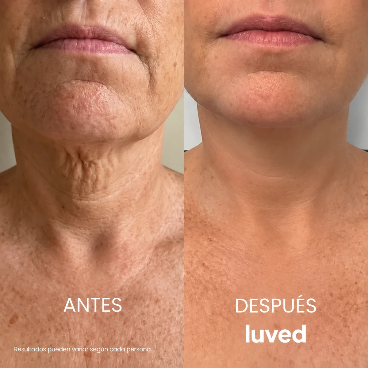 Crema para el cuello Antiedad  Luved® Tonifica y Reafirma